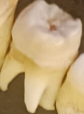 RARE Antique HUMAN TEETH w/ROOTS i-Tooth/Molar/Inscisor/Bicuspid 23 Remain picture