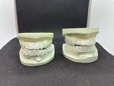 Lot of 2 Sets Vintage Dental Teeth Impression Molds Plaster Matching Upper Lower picture
