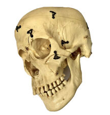 Antique Human Skull Possibly Kilgore Medical With Hinges Oddities Unusual picture