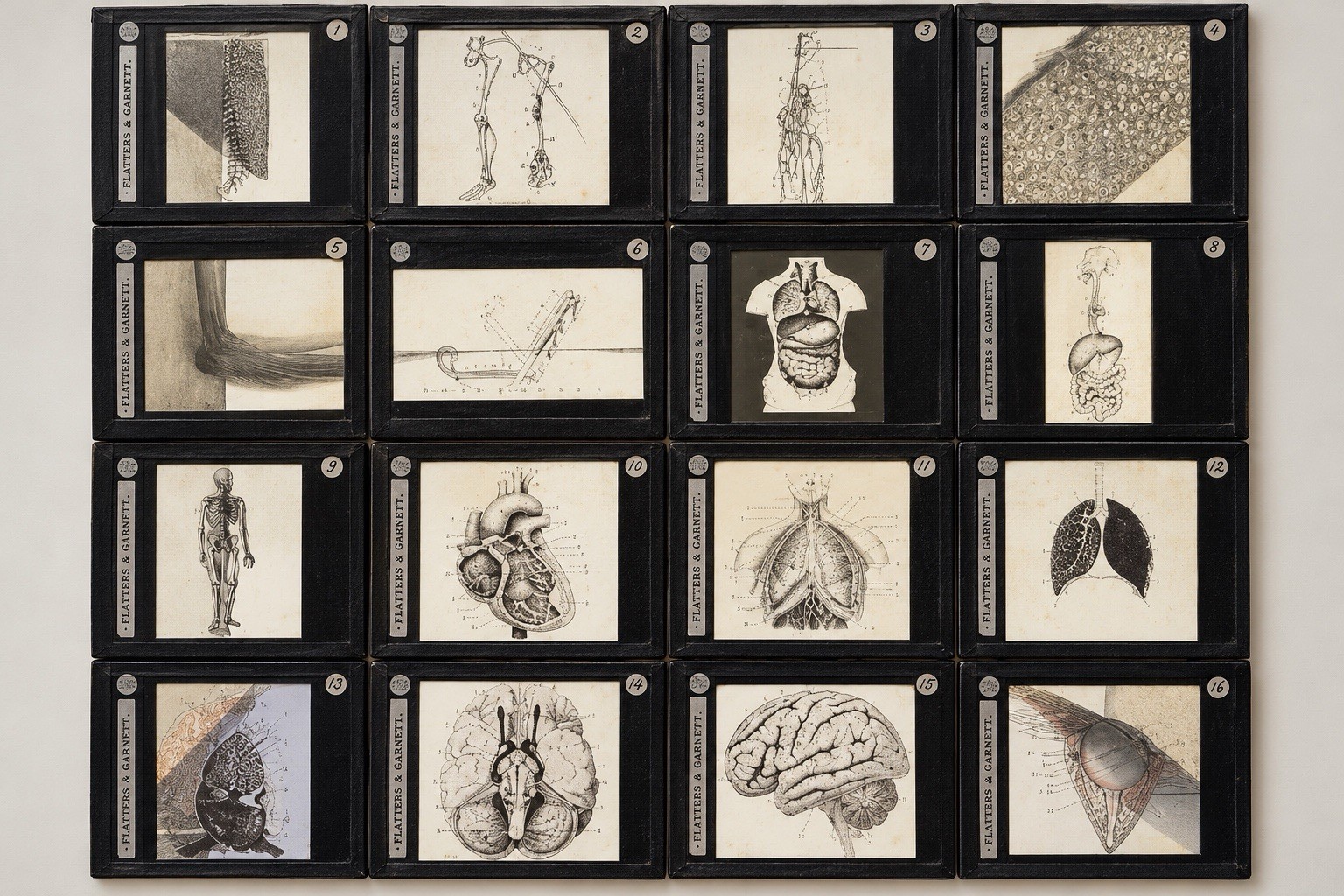 Antique Medical Anatomy Magic Lantern Slides Flatters & Garnett Antique Medical Anatomy Magic Lantern Slides Flatters & Garnett