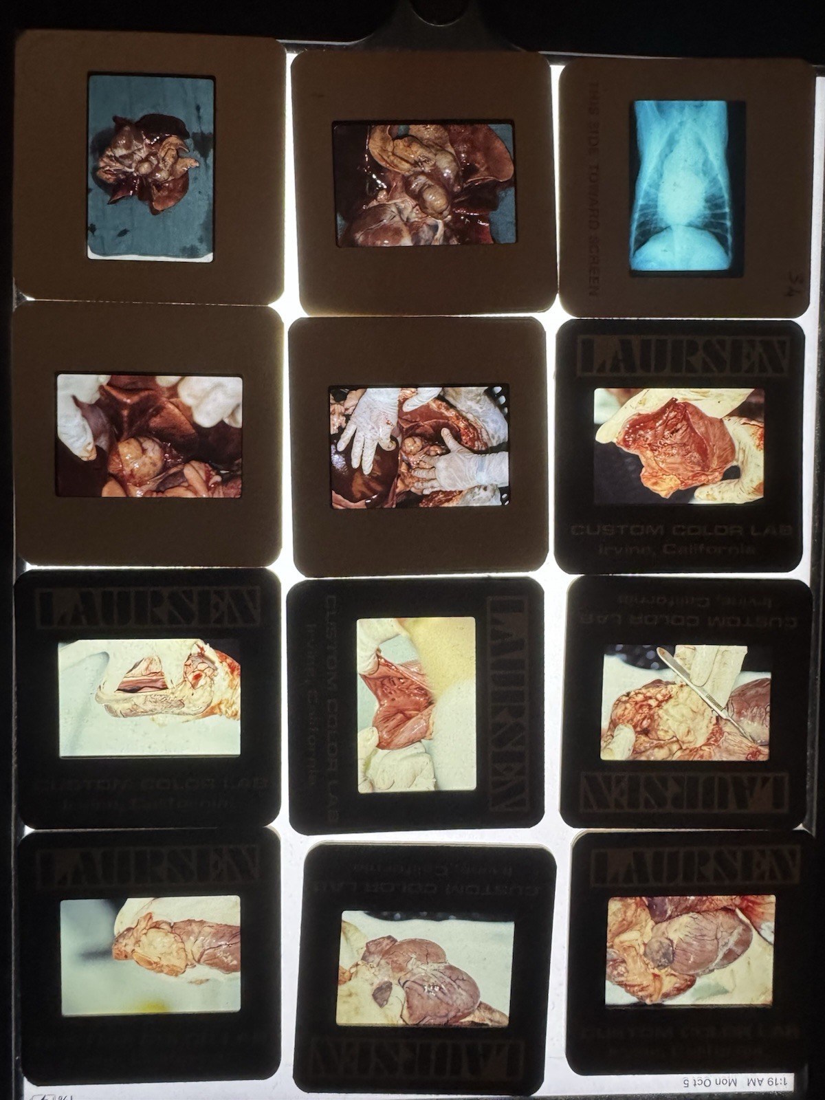 Vintage 1980s Medical Slide Film Lot ~500 slide photographs + Carousels Vintage 1980s Medical Slide Film Lot ~500 slide photographs + Carousels
