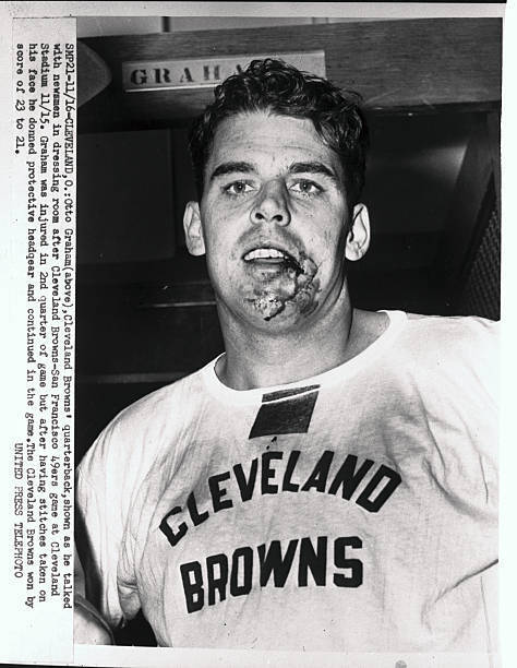 Otto Graham With Bloody and Injured Jaw - Otto Graham, Clevela - 1953 Old Photo