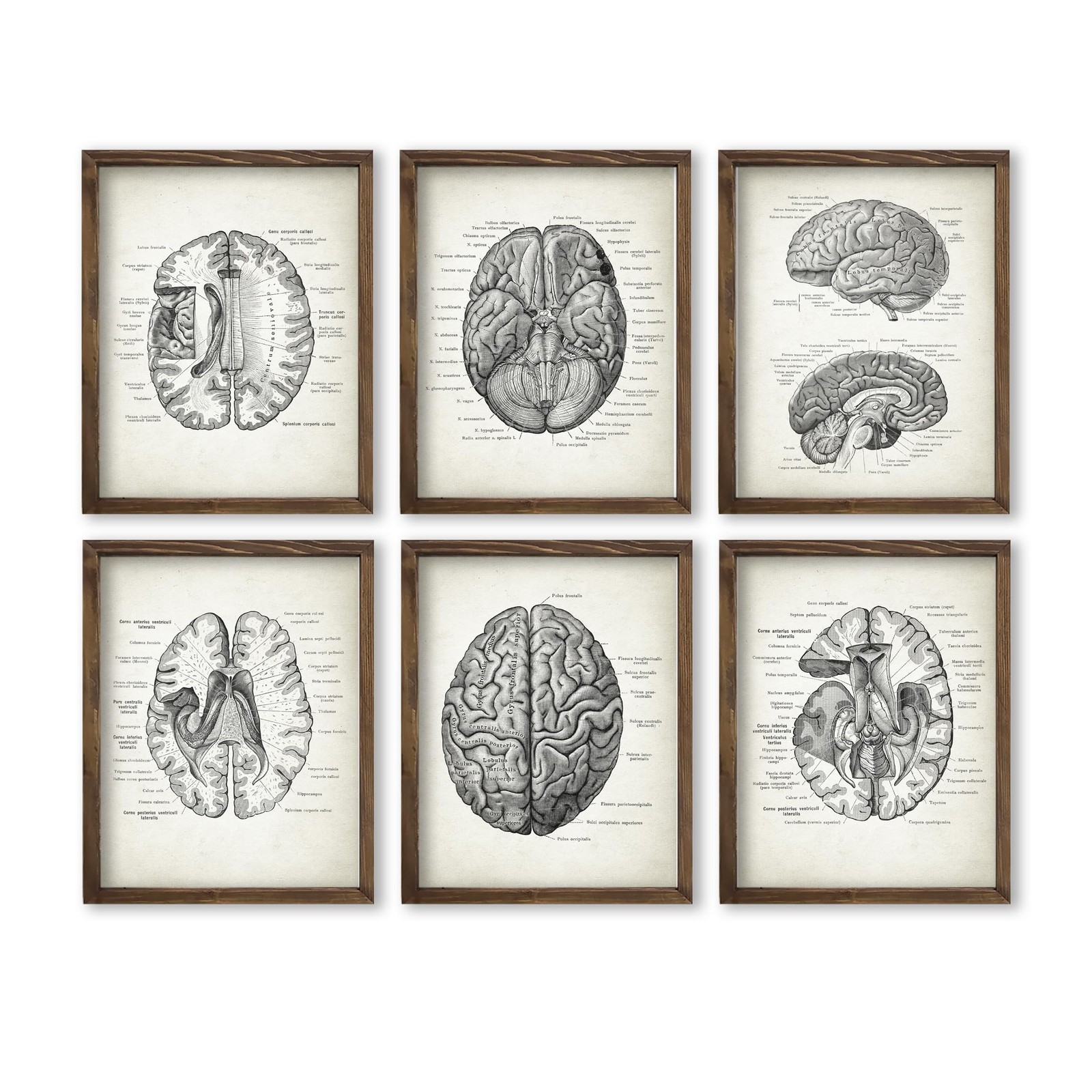 Vintage Human Brain Anatomy Wall Art Print Set of 6, 8x10 Inch Unframed Vintage Human Brain Anatomy Wall Art Print Set of 6, 8x10 Inch Unframed