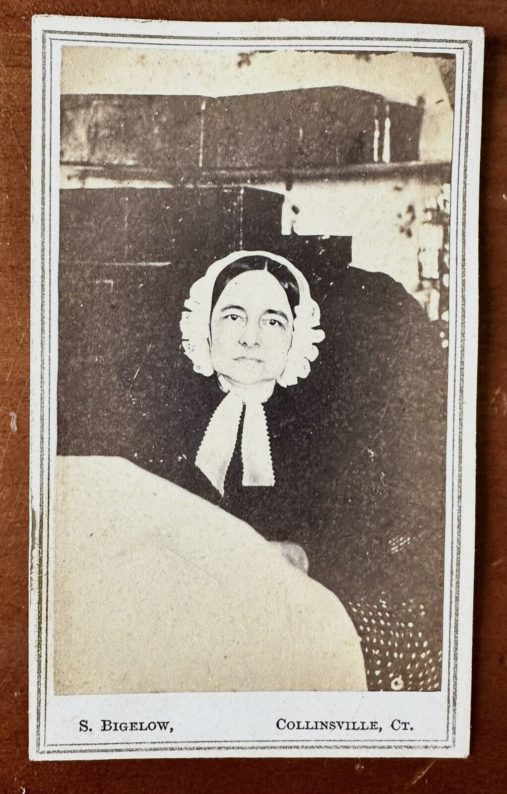Chloe Lankton Disabled Woman 1860s CDV Photo Medical Not Post Mortem Unusual Chloe Lankton Disabled Woman 1860s CDV Photo Medical Not Post Mortem Unusual