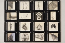 Antique Medical Anatomy Magic Lantern Slides Flatters & Garnett picture