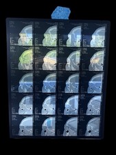 Vintage Medical CT Scan Film Skull Sinus Profile X-Ray Radiology Sheet Skull picture