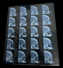 Vintage CT Scan X-Ray Film Sinus Skull Medical Imaging Radiology Transparency picture