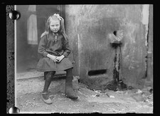 Villars France 1918 Child Tuberculosis Leg American Red Cross St Etienne picture