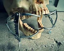Medical Mouth Gag, Mouth Spreader Display, Vintage Medical Style, Oddities picture