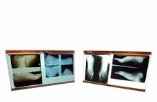 1 VTG Halsey Light Box X-Ray Light Box Light Up Display picture